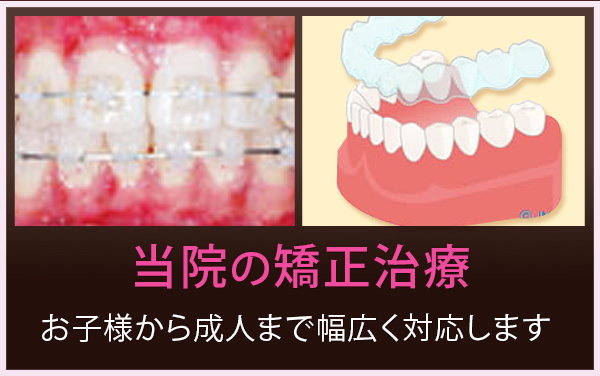 当院の矯正治療